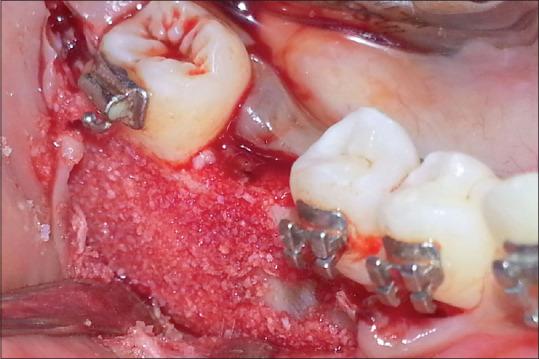 https://cdn.ncbi.nlm.nih.gov/pmc/blobs/7857/7266211/f26d97ada223/JFMPC-9-1752-g009.jpg