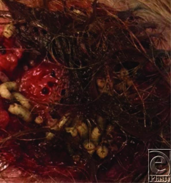 https://cdn.ncbi.nlm.nih.gov/pmc/blobs/7859/4893314/725ee5976e62/eplasty16ic21_fig2.jpg