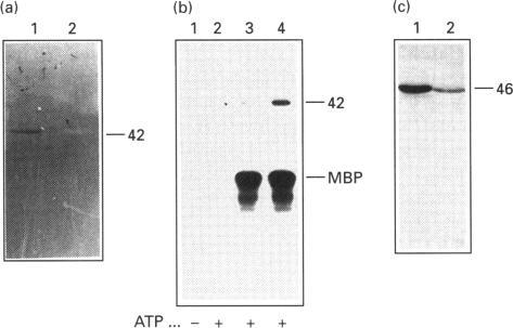 https://cdn.ncbi.nlm.nih.gov/pmc/blobs/785a/1137758/e70a92d6e807/biochemj00097-0222-b.jpg