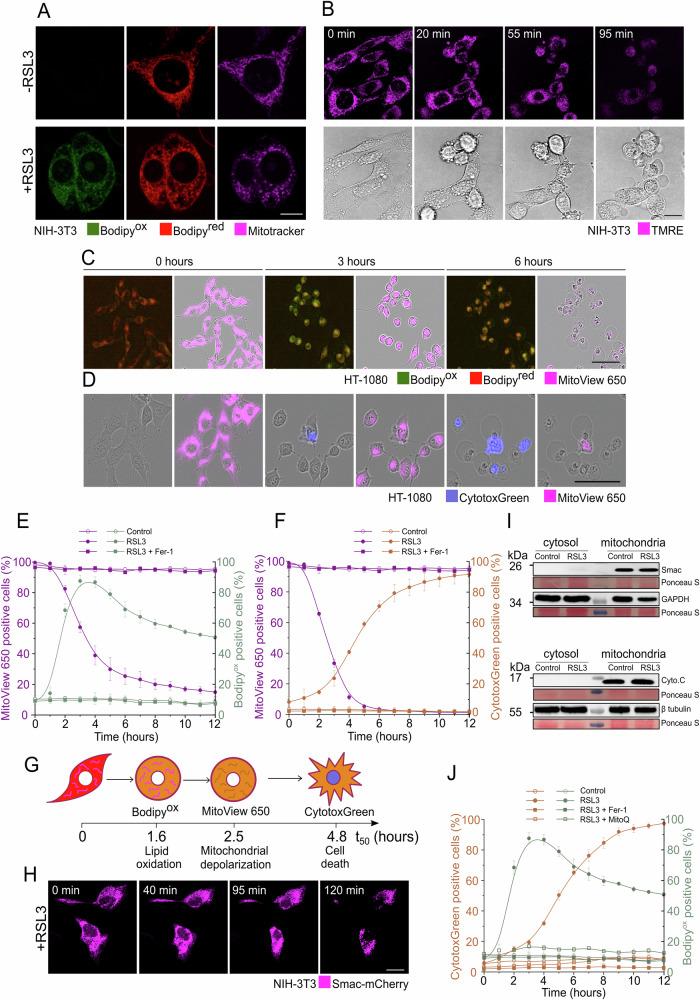 https://cdn.ncbi.nlm.nih.gov/pmc/blobs/7867/11762985/1d855a84fc56/41419_2024_7312_Fig1_HTML.jpg