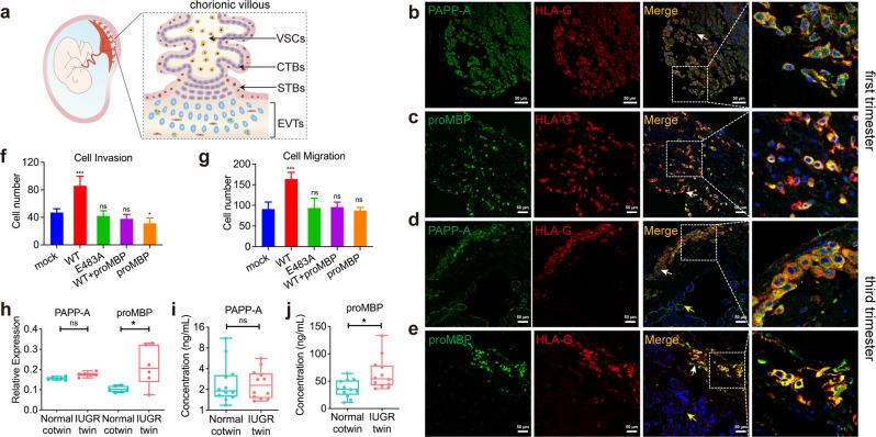 https://cdn.ncbi.nlm.nih.gov/pmc/blobs/786a/9780223/7c330ce5284b/41421_2022_502_Fig6_HTML.jpg