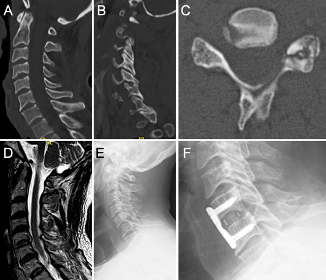 https://cdn.ncbi.nlm.nih.gov/pmc/blobs/7873/10958245/0202268d0aee/EOR-23-0161fig1.jpg