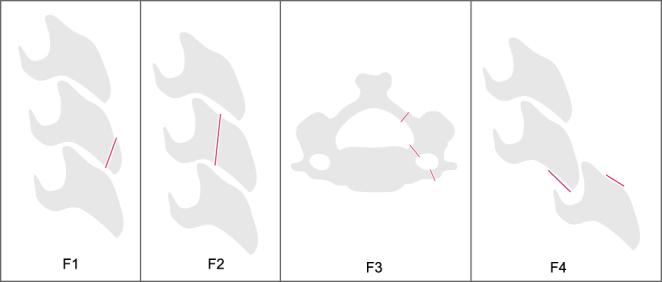 https://cdn.ncbi.nlm.nih.gov/pmc/blobs/7873/10958245/4269c0e4bf1a/EOR-23-0161fig3.jpg