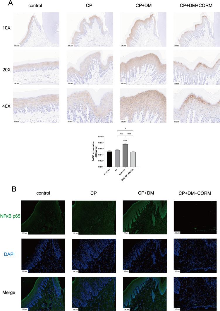 https://cdn.ncbi.nlm.nih.gov/pmc/blobs/7875/11277920/15ca9a3224ac/JIR-17-4845-g0008.jpg