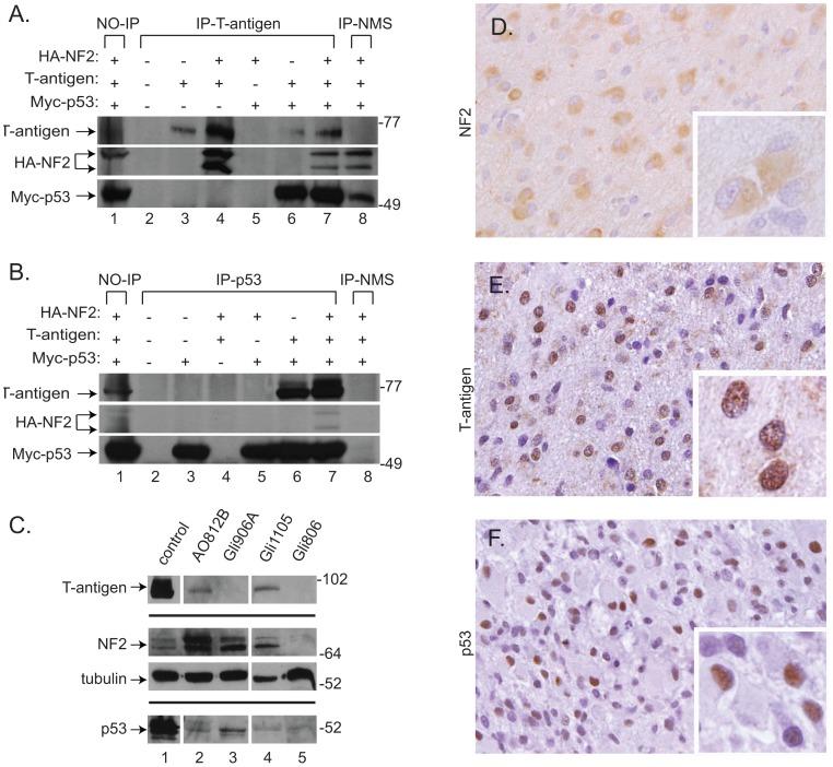 https://cdn.ncbi.nlm.nih.gov/pmc/blobs/7875/3538535/ca3e6bd16e0e/pone.0053447.g005.jpg