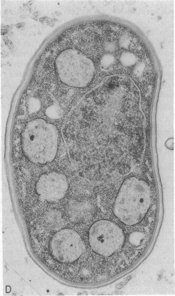 https://cdn.ncbi.nlm.nih.gov/pmc/blobs/7876/393240/a890a18c5bbe/pnas00023-0277-c.jpg