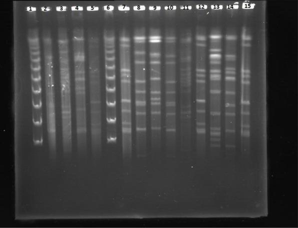 https://cdn.ncbi.nlm.nih.gov/pmc/blobs/787e/11245352/eefbd33ca4ba/IJM-16-323-g001.jpg