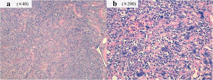 https://cdn.ncbi.nlm.nih.gov/pmc/blobs/7884/6510746/f7316cc81a2a/40792_2019_635_Fig3_HTML.jpg