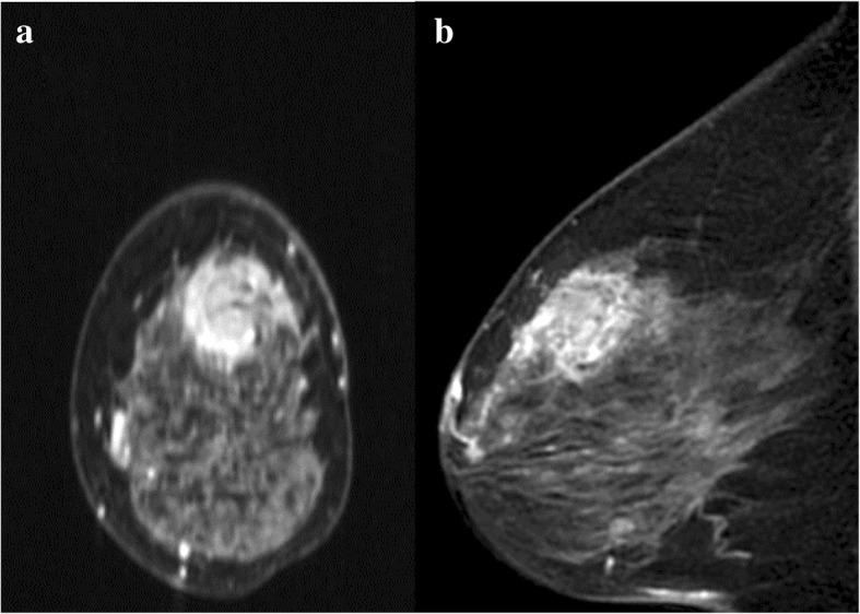 https://cdn.ncbi.nlm.nih.gov/pmc/blobs/7884/6510746/f77655588363/40792_2019_635_Fig2_HTML.jpg