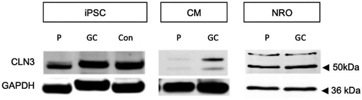 https://cdn.ncbi.nlm.nih.gov/pmc/blobs/788a/8104174/d3ca9b44b4e3/MGG3-9-e1601-g005.jpg