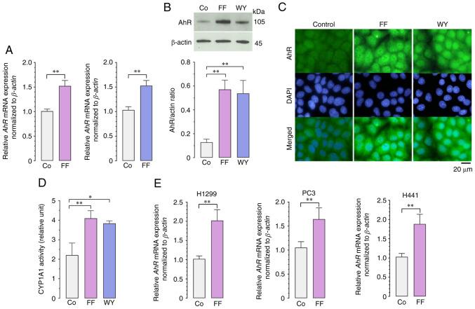 https://cdn.ncbi.nlm.nih.gov/pmc/blobs/7893/10272955/a632faf1a7fc/ol-26-01-13899-g05.jpg