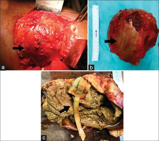 https://cdn.ncbi.nlm.nih.gov/pmc/blobs/7896/6813685/12fbdd5a5841/JPGM-65-247-g002.jpg
