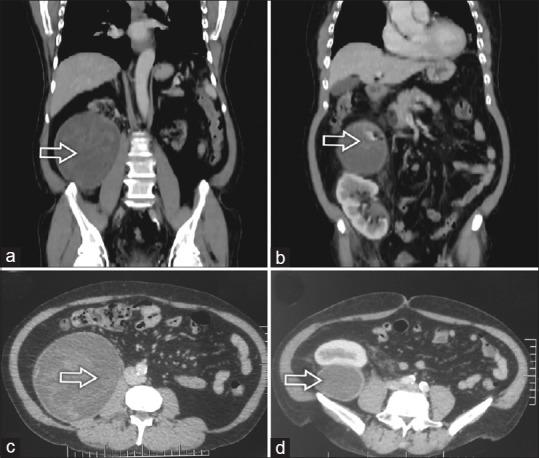 https://cdn.ncbi.nlm.nih.gov/pmc/blobs/7896/6813685/7d654a9892ec/JPGM-65-247-g001.jpg