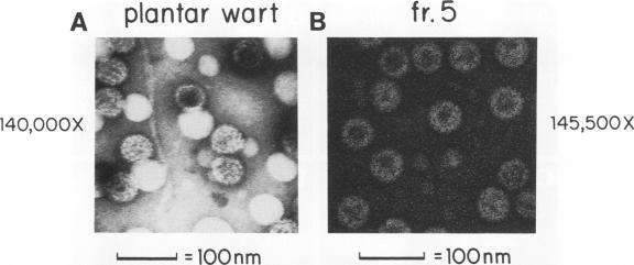 https://cdn.ncbi.nlm.nih.gov/pmc/blobs/7897/237365/d0699d114b91/jvirol00022-0344-a.jpg
