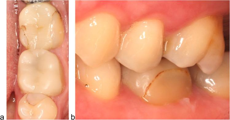 https://cdn.ncbi.nlm.nih.gov/pmc/blobs/7898/10329614/9f47fcaf1a42/784_2023_5023_Fig2_HTML.jpg