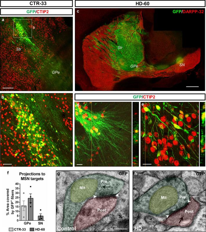 https://cdn.ncbi.nlm.nih.gov/pmc/blobs/7899/11071863/25250cd63d86/18_2023_4882_Fig2_HTML.jpg