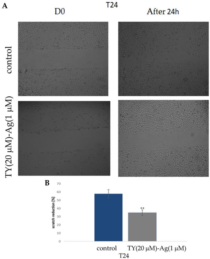 https://cdn.ncbi.nlm.nih.gov/pmc/blobs/78a0/8744882/e64ec4a5f8a5/ijms-23-00026-g015.jpg