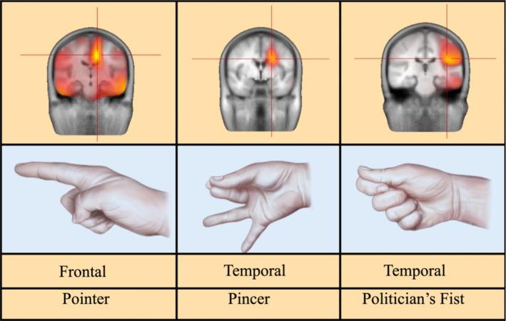 https://cdn.ncbi.nlm.nih.gov/pmc/blobs/78a2/12065125/5476819bde47/EPD2-27-311-g001.jpg