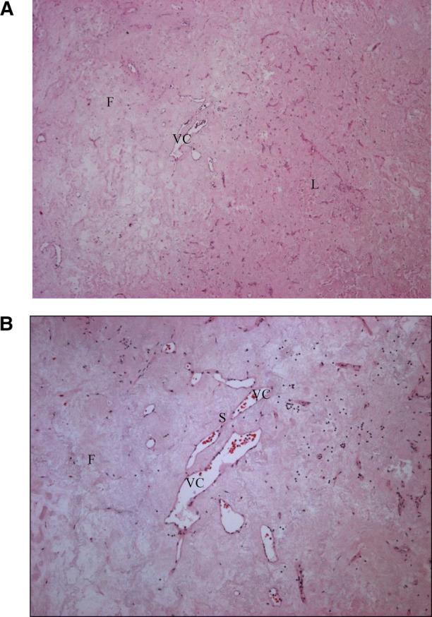 https://cdn.ncbi.nlm.nih.gov/pmc/blobs/78a2/9834279/d796cd76f1a0/fsurg-09-985849-g003.jpg
