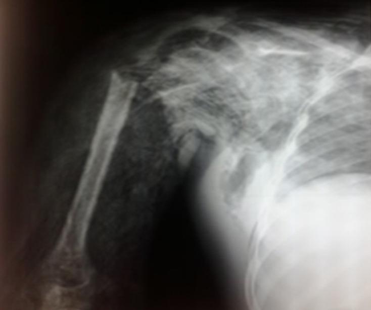 https://cdn.ncbi.nlm.nih.gov/pmc/blobs/78a3/10768548/6232cb42ff3d/PAMJ-46-49-g001.jpg