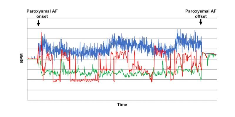 https://cdn.ncbi.nlm.nih.gov/pmc/blobs/78a3/7003123/7aaf3681a418/cardio_v4i1e14857_fig5.jpg
