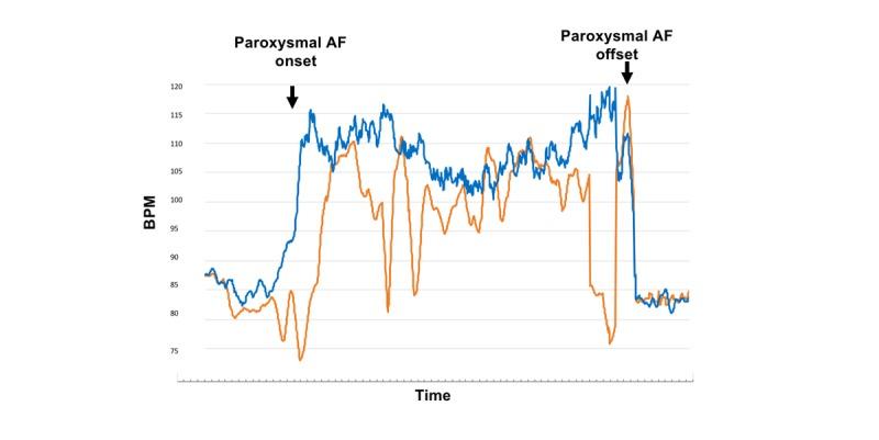 https://cdn.ncbi.nlm.nih.gov/pmc/blobs/78a3/7003123/9c9b853e7f8b/cardio_v4i1e14857_fig4.jpg