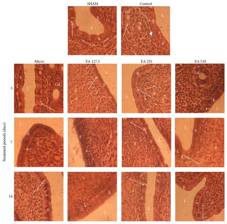 https://cdn.ncbi.nlm.nih.gov/pmc/blobs/78a5/5804318/7241e42f50cd/ECAM2017-8563909.004.jpg