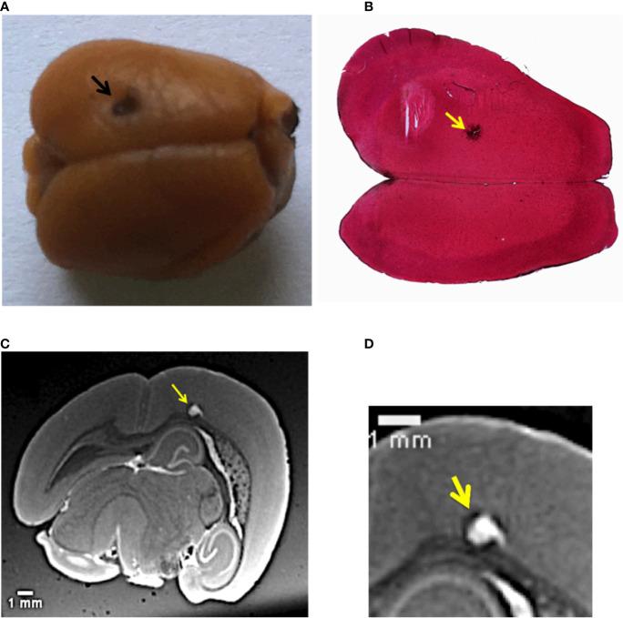 https://cdn.ncbi.nlm.nih.gov/pmc/blobs/78a7/8185349/dc3dc16e877b/fonc-11-554668-g001.jpg