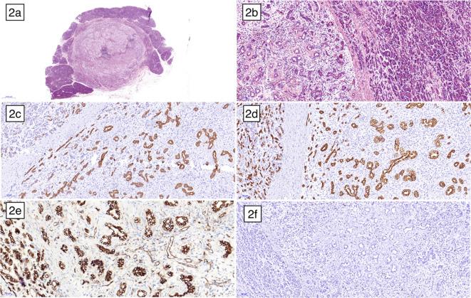 https://cdn.ncbi.nlm.nih.gov/pmc/blobs/78b8/11369897/6b92211d2fe3/fonc-14-1418244-g002.jpg