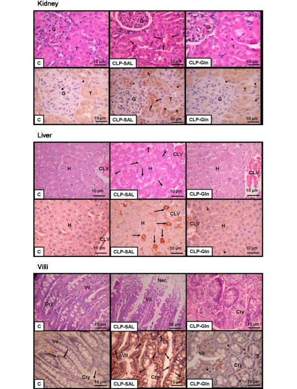 https://cdn.ncbi.nlm.nih.gov/pmc/blobs/78b8/2717436/fa0615fdc727/cc7888-6.jpg