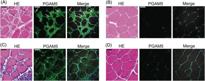 https://cdn.ncbi.nlm.nih.gov/pmc/blobs/78bd/9397554/f30fa5cef574/JCSM-13-2118-g006.jpg