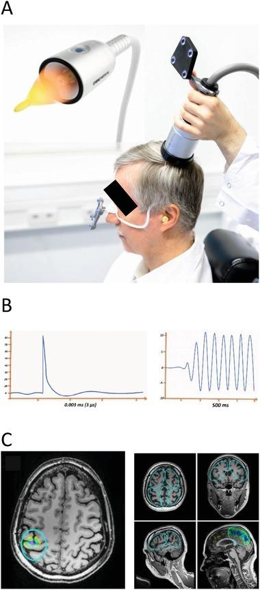 https://cdn.ncbi.nlm.nih.gov/pmc/blobs/78c0/7001626/458775099d88/ADVS-7-1902583-g001.jpg