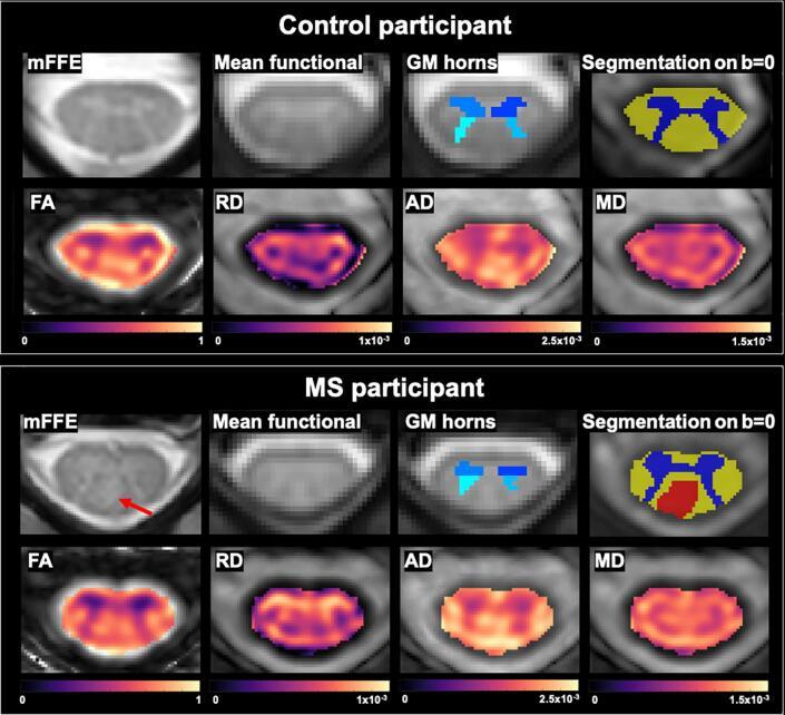 https://cdn.ncbi.nlm.nih.gov/pmc/blobs/78c6/9421501/4ad90be0bd94/gr1.jpg