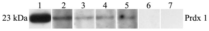 https://cdn.ncbi.nlm.nih.gov/pmc/blobs/78c7/3820583/fb91bdb396ac/OR-30-05-2297-g01.jpg