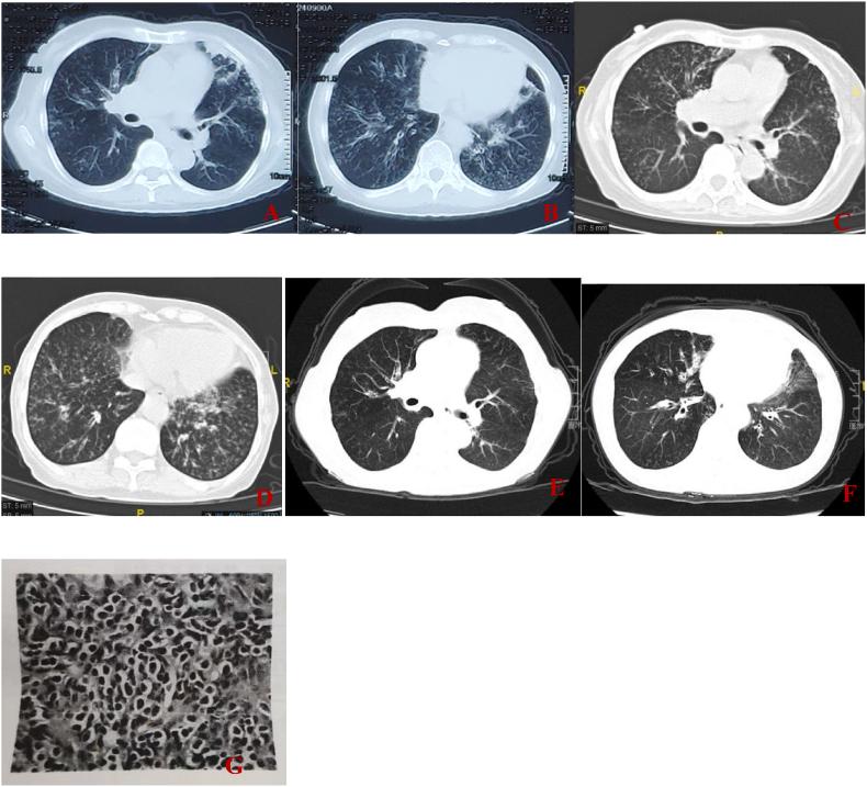 https://cdn.ncbi.nlm.nih.gov/pmc/blobs/78c8/10765483/5b1ac9578579/gr1.jpg