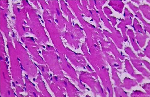 https://cdn.ncbi.nlm.nih.gov/pmc/blobs/78c8/11131629/28b5f2e6aeab/JMedLife-17-157-g005.jpg