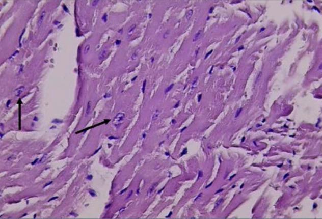 https://cdn.ncbi.nlm.nih.gov/pmc/blobs/78c8/11131629/8c525e580be2/JMedLife-17-157-g004.jpg