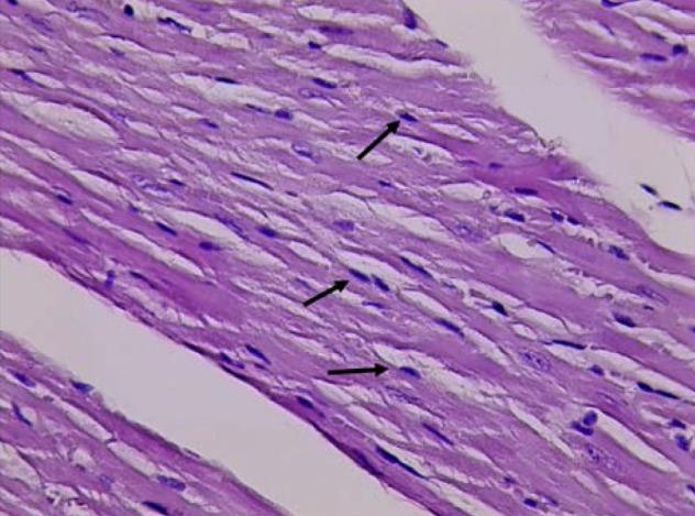 https://cdn.ncbi.nlm.nih.gov/pmc/blobs/78c8/11131629/e01161b4bda1/JMedLife-17-157-g003.jpg