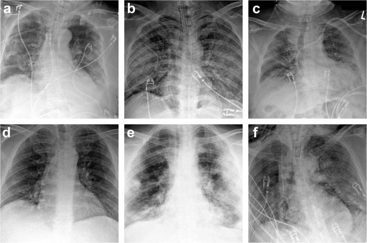 https://cdn.ncbi.nlm.nih.gov/pmc/blobs/78c8/9813561/20e701d52998/gr3_lrg.jpg