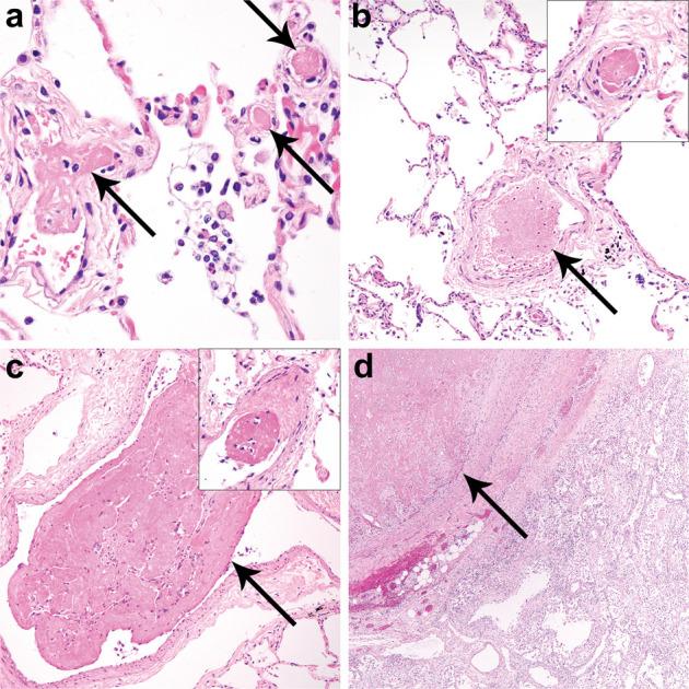 https://cdn.ncbi.nlm.nih.gov/pmc/blobs/78c8/9813561/9422c4281ec2/gr6_lrg.jpg