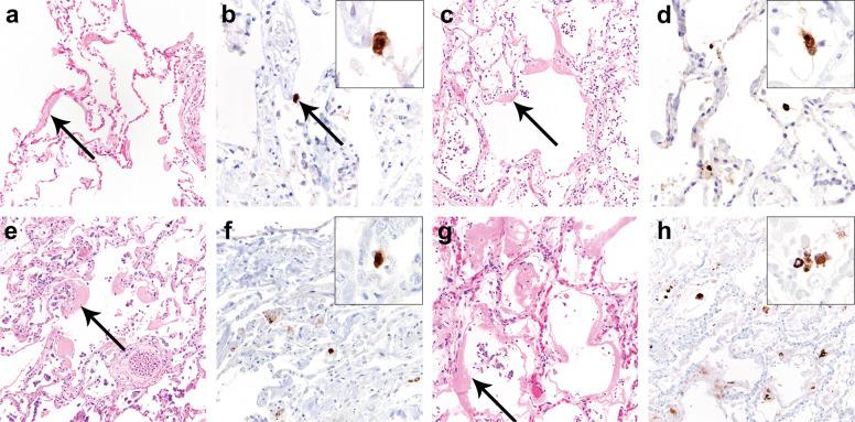 https://cdn.ncbi.nlm.nih.gov/pmc/blobs/78c8/9813561/e582cf67c4e8/gr4_lrg.jpg