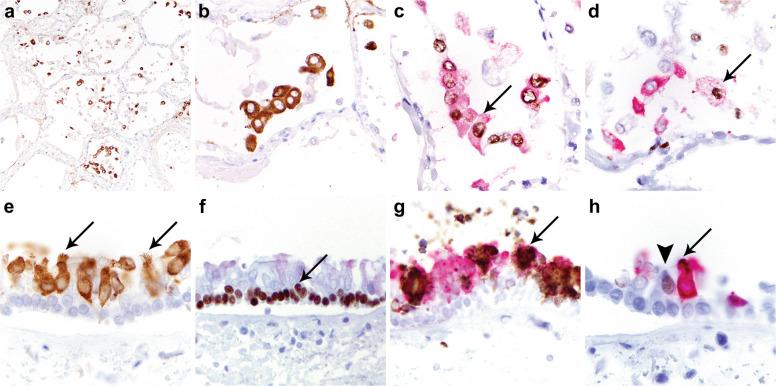 https://cdn.ncbi.nlm.nih.gov/pmc/blobs/78c8/9813561/f0688ce58a47/gr7_lrg.jpg