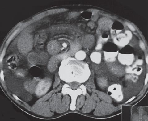 https://cdn.ncbi.nlm.nih.gov/pmc/blobs/78ca/5106572/538b55afefab/IJMS-41-548-g001.jpg