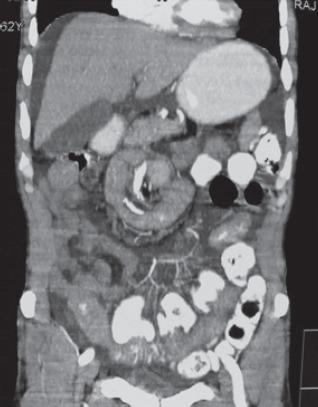 https://cdn.ncbi.nlm.nih.gov/pmc/blobs/78ca/5106572/eeb5a48a99b1/IJMS-41-548-g002.jpg