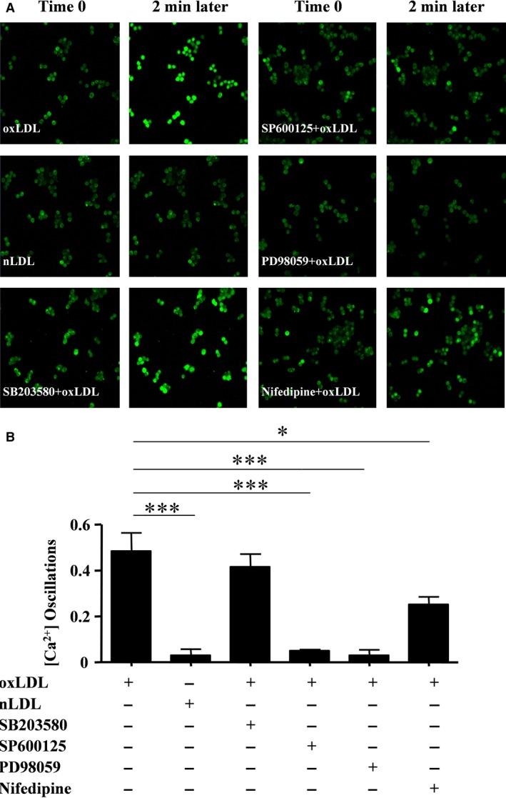 https://cdn.ncbi.nlm.nih.gov/pmc/blobs/78cb/5387129/b352141a91c5/JCMM-21-929-g006.jpg