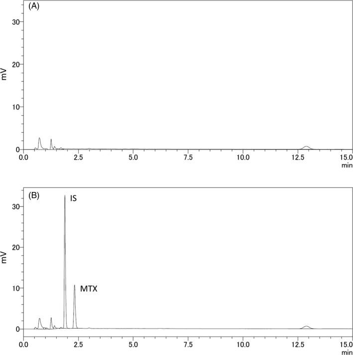 https://cdn.ncbi.nlm.nih.gov/pmc/blobs/78cb/7957986/9669246a0c98/JCLA-35-e23661-g004.jpg