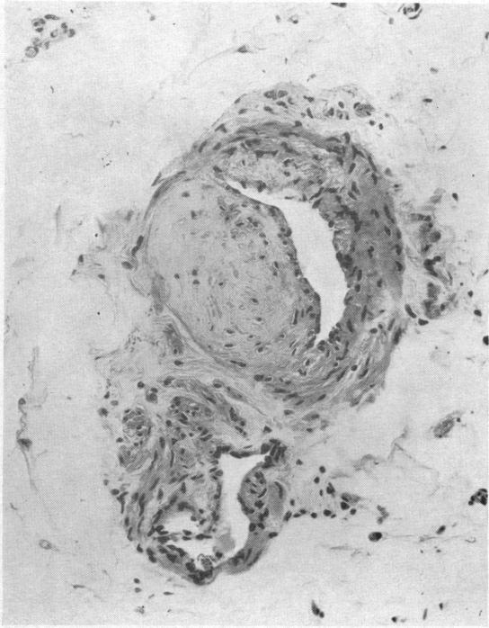 https://cdn.ncbi.nlm.nih.gov/pmc/blobs/78da/2166472/67a513be158d/brmedj02392-0035-b.jpg
