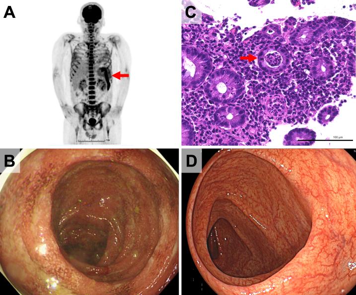 https://cdn.ncbi.nlm.nih.gov/pmc/blobs/78dc/10834227/31044e4a4ffa/2433-3298-7-1-0127-g001.jpg