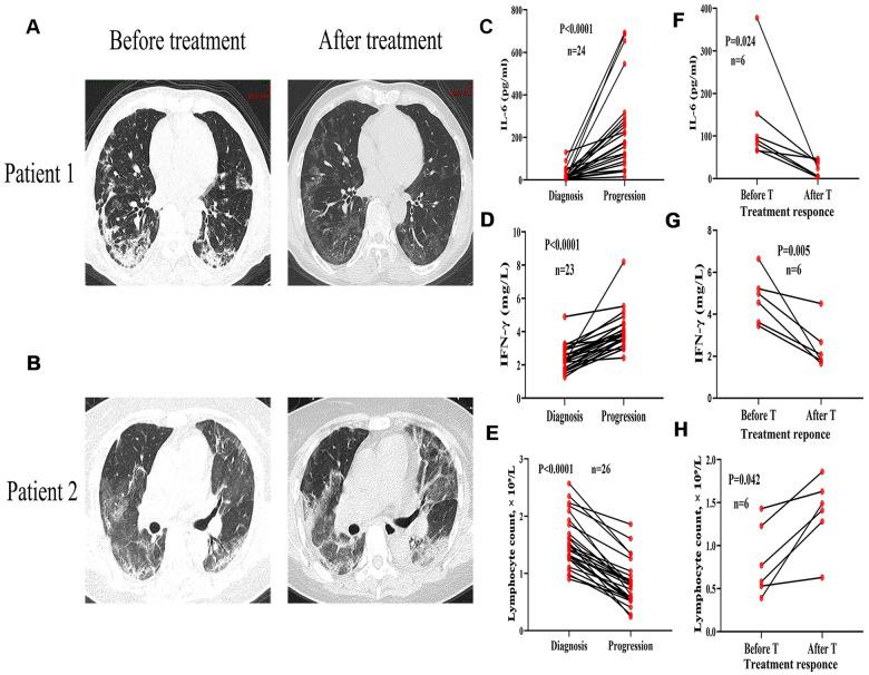 https://cdn.ncbi.nlm.nih.gov/pmc/blobs/78e2/7746365/4f9f283307ef/aging-12-202172-g004.jpg