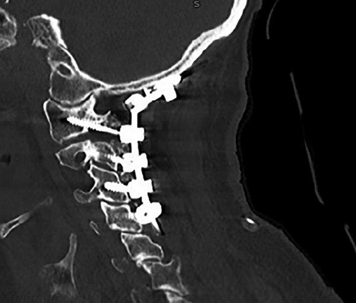 https://cdn.ncbi.nlm.nih.gov/pmc/blobs/78e7/8271251/01134e462c7e/CCR3-9-e04421-g003.jpg